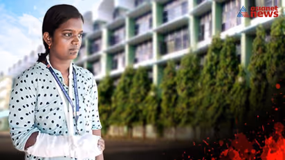 Kerala nurse suffers hand fracture after attack by patient