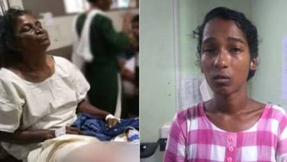 മുഖം മൂടി ധരിച്ച് വയോധികയുടെ കാല് തല്ലിയൊടിച്ചത് മരുമകൾ, പിടിയിൽ