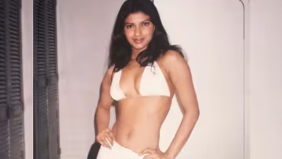 'ദേഹത്തെല്ലാം പാടുകളായിരുന്നു, മുടി ഡ്രൈ ആയി പൊങ്ങിയിരിക്കും- ഒട്ടും ആത്മവിശ്വാസമില്ലായിരുന്നു'