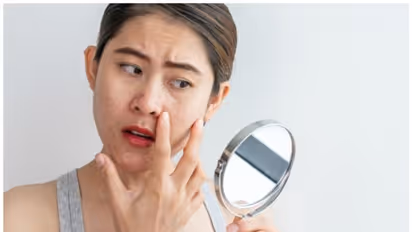 കണ്ണിന് ചുറ്റുമുള്ള കറുപ്പ് മാറാൻ പരീക്ഷിക്കാം ഈ പൊടിക്കെെകൾ 