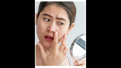 உங்கள் கண்கள் வீங்கி இருந்தால் இந்த டிப்ஸ கொஞ்சம் ட்ரை பண்ணி பாருங்க..!!