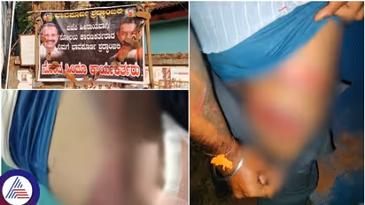 ಬಿಜೆಪಿ ನಾಯಕರ ಶ್ರದ್ಧಾಂಜಲಿ ಬ್ಯಾನರ್ ಹಾಕಿದವರ, ಚರ್ಮ ಸುಲಿದ ಪೊಲೀಸರು! 