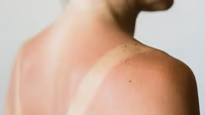 Health Tips: സൂര്യാഘാതം; ലക്ഷണങ്ങള് എന്തെല്ലാം? ശ്രദ്ധിക്കേണ്ട കാര്യങ്ങള്...