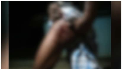 മലപ്പുറത്ത് കരടിയുടെ ആക്രമണത്തിൽ ആദിവാസി യുവാവിന് പരിക്ക്; തൃശൂരിൽ കാട്ടുപന്നി സ്കൂട്ടർ ഇടിച്ചിട്ടു