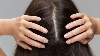 താരനും തലമുടി കൊഴിച്ചിലും തടയാനും മുടി വളരാനും അടുക്കളയിലുള്ള ഈ ഒറ്റ ചേരുവ മാത്രം മതി! 