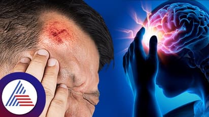 Health Tips: ತಲೆಗೆ ಗಾಯವಾದ್ರೆ ನಿರ್ಲಕ್ಷ್ಯ ಬೇಡ, ಚಿಕಿತ್ಸೆ ಹೀಗಿರಲಿ!