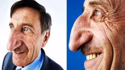 നീളമുള്ള മൂക്ക് കൊണ്ട് ലോകമാകെ അറിയപ്പെട്ട ടർക്കിഷ് പൗരൻ ഓർമ്മയായി