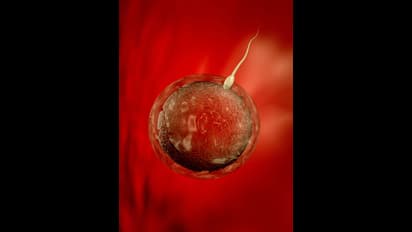 IVF: భార్యకు వేరే వ్యక్తి వీర్యకణాలను ఎక్కించారు.. ఆమె డెలివరీ తర్వాత వెలుగులోకి విషయం.. రూ. 1.5 కోట్ల ఫైన్