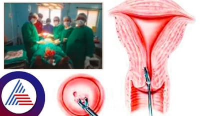 ಬೆಳಗಾವಿ: ಗರ್ಭಕೋಶದಲ್ಲಿ 2.5 ಕೆಜಿ ಗಡ್ಡೆ ಪತ್ತೆ; ಶಸ್ತ್ರ ಚಿಕಿತ್ಸೆ ಯಶಸ್ವಿ