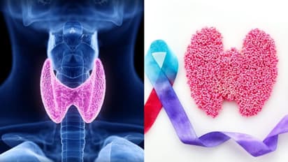 ಬ್ಯುಸಿ ಜೀವನದಲ್ಲಿ ಥೈರಾಯ್ಡ್ ಆರೋಗ್ಯ ಮರೆಯಬೇಡಿ