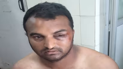 ಚಿಕ್ಕಮಗಳೂರು: ಅನ್ಯಕೋಮಿನ ಮಹಿಳೆಯ ಮನೆಯಲ್ಲಿ ಸಿಕ್ಕಿಬಿದ್ದ ಯುವಕನ ಮೇಲೆ ಮಾರಣಾಂತಿಕ ಹಲ್ಲೆ 