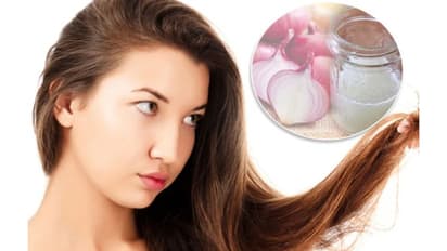 തലമുടി കൊഴിച്ചിലും താരനും അകറ്റാന്‍ പരീക്ഷിക്കാം ഉള്ളി കൊണ്ടുള്ള പൊടിക്കൈകള്‍...