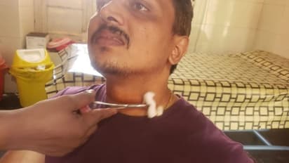 വീണ്ടും കേബിൾ അപകടം: ബൈക്കിൽ പോയ യുവാവിന്റെ കഴുത്തിൽ കുടുങ്ങി, പരിക്ക്