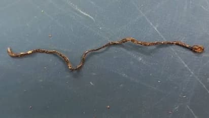 മൂന്നുവയസുകാരൻ പാമ്പിനെ ചവച്ചുകൊന്നു!