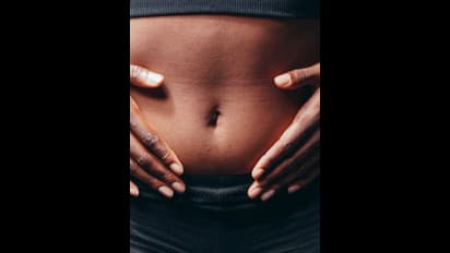 ಹೊಕ್ಕುಳಿನಿಂದ ವಾಸನೆ ಬರುತ್ತಿದೆಯೇ? ಇದನ್ನು ನಿರ್ಲಕ್ಷಿಸಲೇಬೇಡಿ… 