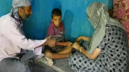 ಅನಾರೋಗ್ಯ ಪೀಡಿತ ಮಗನ ಚಿಕಿತ್ಸೆಗಾಗಿ ಆಸ್ತಿ ಕಳೆದುಕೊಂಡ ತಂದೆ-ತಾಯಿ: ನೆರವಿನ ನಿರೀಕ್ಷೆಯಲ್ಲಿ ಬಡಕುಟುಂಬ..!