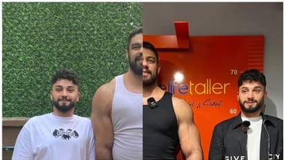 ആറടി ഉയരമുള്ളയാള് വീണ്ടും ഏഴ് ഇഞ്ച് കൂട്ടാനായി ചെലവഴിക്കുന്നത് 88 ലക്ഷം !