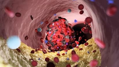 കൊളസ്ട്രോളിനെ കുറയ്ക്കാന് സഹായിക്കും പതിവായി കഴിക്കുന്ന ഈ ഭക്ഷണങ്ങള്...