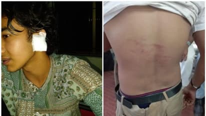 വില്ല്യാപ്പള്ളി എംഇഎസ് കോളേജിൽ റാഗിംഗെന്ന് പരാതി; നാല് വിദ്യാർത്ഥികൾ പരിക്കേറ്റു