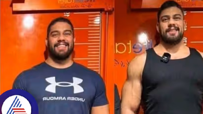 ಅಬ್ಬಬ್ಬಾ..ಏಳು ಇಂಚು ಹೆಚ್ಚಿಸಿಕೊಳ್ಳಲು 88 ಲಕ್ಷ ರೂಪಾಯಿ ಖರ್ಚು ಮಾಡಿದ ಭೂಪ!