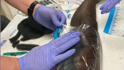 കയ്യേറ്റത്തിനിടെ ബന്ധുവിന്‍റെ കടിയേറ്റു; ശേഷം മാംസം ഭക്ഷിക്കുന്ന ബാക്ടീരിയല്‍ അണുബാധയിലേക്ക്...