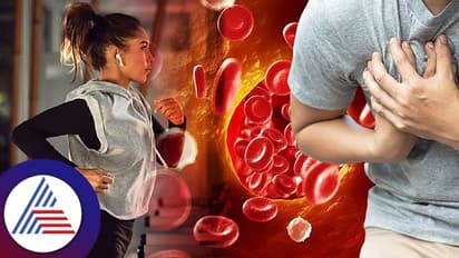 ಕೊಲೆಸ್ಟ್ರಾಲ್‌ ಹೃದಯದ ಕಾಯಿಲೆಗೆ ಕಾರಣವಾಗುತ್ತೆ, ಮ್ಯಾನೇಜ್ ಮಾಡಲು ಈ ಎಕ್ಸರ್‌ಸೈಸ್ ಮಾಡಿ