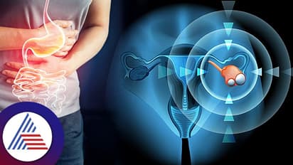 Women Health: ಮುಟ್ಟಾದಾಗ ಬೇಗ ಬೆಳೆಯುತ್ತೆ ಓವೆರಿಯನ್ ಸಿಸ್ಟ್