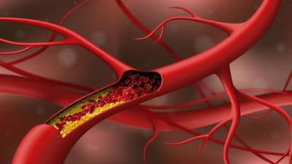 കൊളസ്ട്രോള്‍ കുറയ്ക്കാന്‍ ഡയറ്റില്‍ ഉള്‍പ്പെടുത്താം ഈ നാല് പഴങ്ങള്‍...