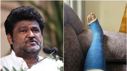 ಕಾಲು ಮುರಿದುಕೊಂಡ ನವರಸನಾಯಕ ಜಗ್ಗೇಶ್: ಸಂಪೂರ್ಣ ವಿಶ್ರಾಂತಿಗೆ ವೈದ್ಯರ ಸೂಚನೆ 