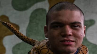 പാമ്പിനെ കഴുത്തിലിട്ടും മുതലകളെ തലോടിയും തെറാപ്പി!