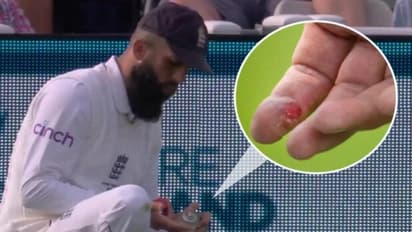 கொஞ்சம் கூட மனசாட்சி வேண்டாமா? காயத்துக்கு மருந்து கூட போடக் கூடாதா? ஐசிசியை விளாசிய பிராட் ஹாக்!