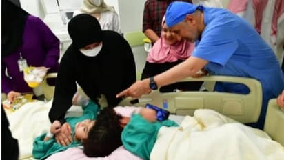 17 മണിക്കൂറുകള് നീണ്ട സങ്കീര്ണമായ ശസ്ത്രക്രിയ വിജയംകണ്ടു; സല്മയും സാറയും ഇനി രണ്ട് രണ്ടായി ജീവിക്കും