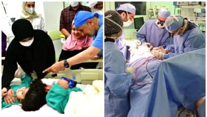 ഒട്ടിപ്പിടിച്ച തലകളുമായുള്ള ദുരിതജീവിതം ഇനിയില്ല; സല്മയെയും സാറയെയും ഡോക്ടര്മാര് വിജയകരമായി വേര്പ്പെടുത്തി