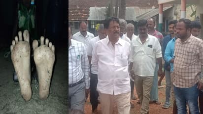 Tumakuru: ಮಕ್ಕಳಲ್ಲಿ ಕಾಣಿಸಿಕೊಂಡ ಚರ್ಮದ ಫಂಗಸ್ ಸೋಂಕು: ಶಾಲೆಗೆ ಶಾಸಕ ಎಂ.ಟಿ.ಕೃಷ್ಣಪ್ಪ ಭೇಟಿ