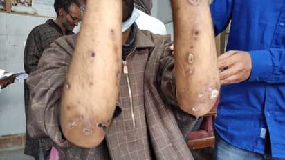 കശ്മീരില് മയക്കുമരുന്ന് ഉപയോഗം കൂടുന്നു, മുന്നറിയിപ്പുമായി മാനസികാരോഗ്യ വിദഗ്ധന്