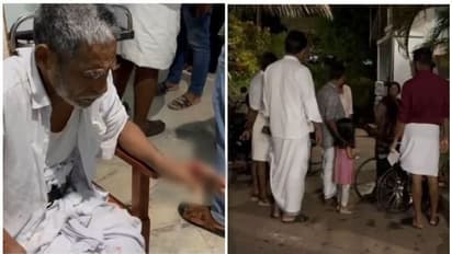 വടകരയിൽ കുറുക്കന്റെ ആക്രമണം; 4 വയസുകാരിയെ വീടിനുള്ളില് കയറി കടിച്ചു