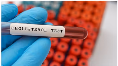 ശരീരത്തിലെ ഉയര്ന്ന കൊളസ്ട്രോള് ; 5 കാര്യങ്ങൾ അറിഞ്ഞിരിക്കൂ