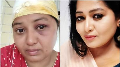 ಜಮೀನು ವಿವಾದ: 'ಹುಡುಗರು' ಸಿನಿಮಾ ನಟಿ ಅನುಗೌಡ ಮೇಲೆ ಹಲ್ಲೆ, ಆಸ್ಪತ್ರೆಗೆ ದಾಖಲು