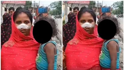 ಪತ್ನಿಯ ಮೂಗು ಕತ್ತರಿಸಿ, ಕಿಸೆಯಲ್ಲಿ ಇಟ್ಕೊಂಡು ಪರಾರಿಯಾದ ಗಂಡ!