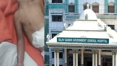 குழந்தை கை இழந்த விவகாரம்: விசாரணை அறிக்கை வெளியீடு!