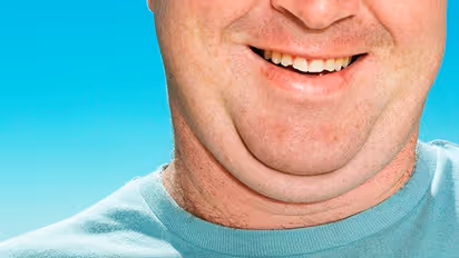 Say goodbye to double chin: 5 effective strategies for a perfect jawline