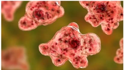 ആലപ്പുഴയിൽ 15കാരൻ മരിച്ചതിന് പിന്നിൽ ഈ അപൂർവ രോഗം