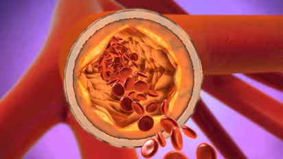 ഉയർന്ന കൊളസ്ട്രോളിനോട് വിട പറയാന് ഈ ഭക്ഷണങ്ങള് കഴിക്കാം...