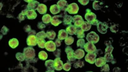 കൊലയാളി അമീബ: മൂക്ക് വഴി തലച്ചോറിലെത്തും, പനിയിൽ തുടങ്ങി മരണം വരെ; ആർക്കും പിടിപെടാം, വേണ്ടത് ജാഗ്രത