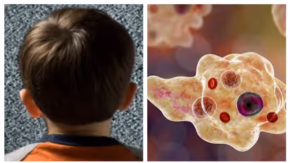 അപൂർവ രോഗത്തെ കരുതിയിരിക്കണം, കുട്ടികളിൽ മുൻകരുതൽ അതീവ പ്രധാനം, മഴക്കാലത്ത് ജാഗ്രത, ആരോഗ്യവകുപ്പ് നിർദ്ദേശങ്ങൾ