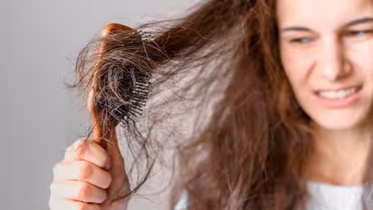 Hydration to Natural care: 5 ways to prevent hair loss in Monsoons