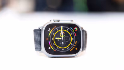 Here's why Apple Watch may not be healthy for you