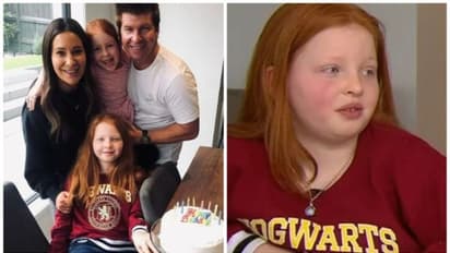 വലതുകാലിന്റെ ചലനശേഷി നഷ്ടപ്പെട്ടു, 10 വയസുകാരിയെ അലട്ടുന്ന അപൂർവ രോഗാവസ്ഥ