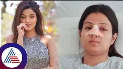  ರಸ್ತೆಯಲ್ಲಿ ಮುಗ್ಗರಿಸಿ ಬಿದ್ದ ಕಿರುತೆರೆ ನಟಿ ಸುಮತಿ; ಮೂಗು ಪುಡಿಪುಡಿ, ಆಪರೇಷನ್‌ ನಂತರ ಲಕ್ಷಣನೇ ಇಲ್ಲ ಎಂದು ಕಣ್ಣೀರು! 