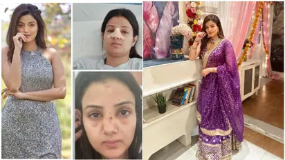 Actress Sumati Singh talks about her emotional distress after nose surgery